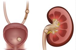 Питание при дисметаболических нарушениях