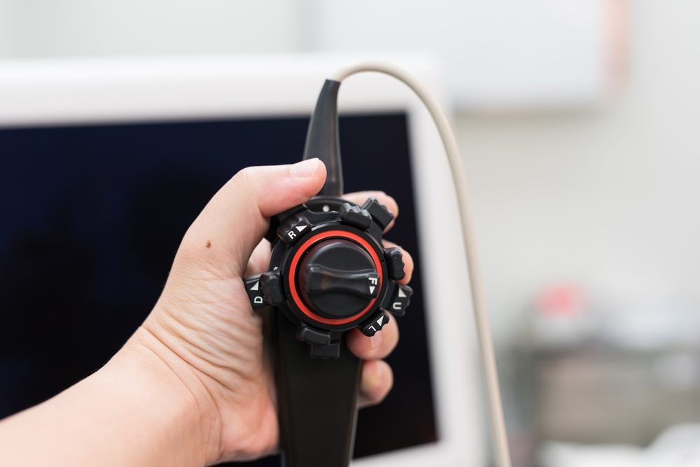 Чреспищеводная эхокардиография (ЧПЭхоКГ)