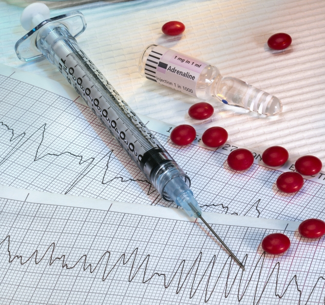 Трепетание и фибрилляция желудочков: симптомы и лечение