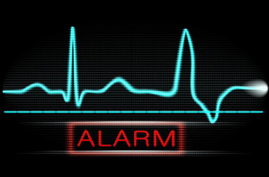 Экстрасистолия желудочковая: причины, признаки, лечение