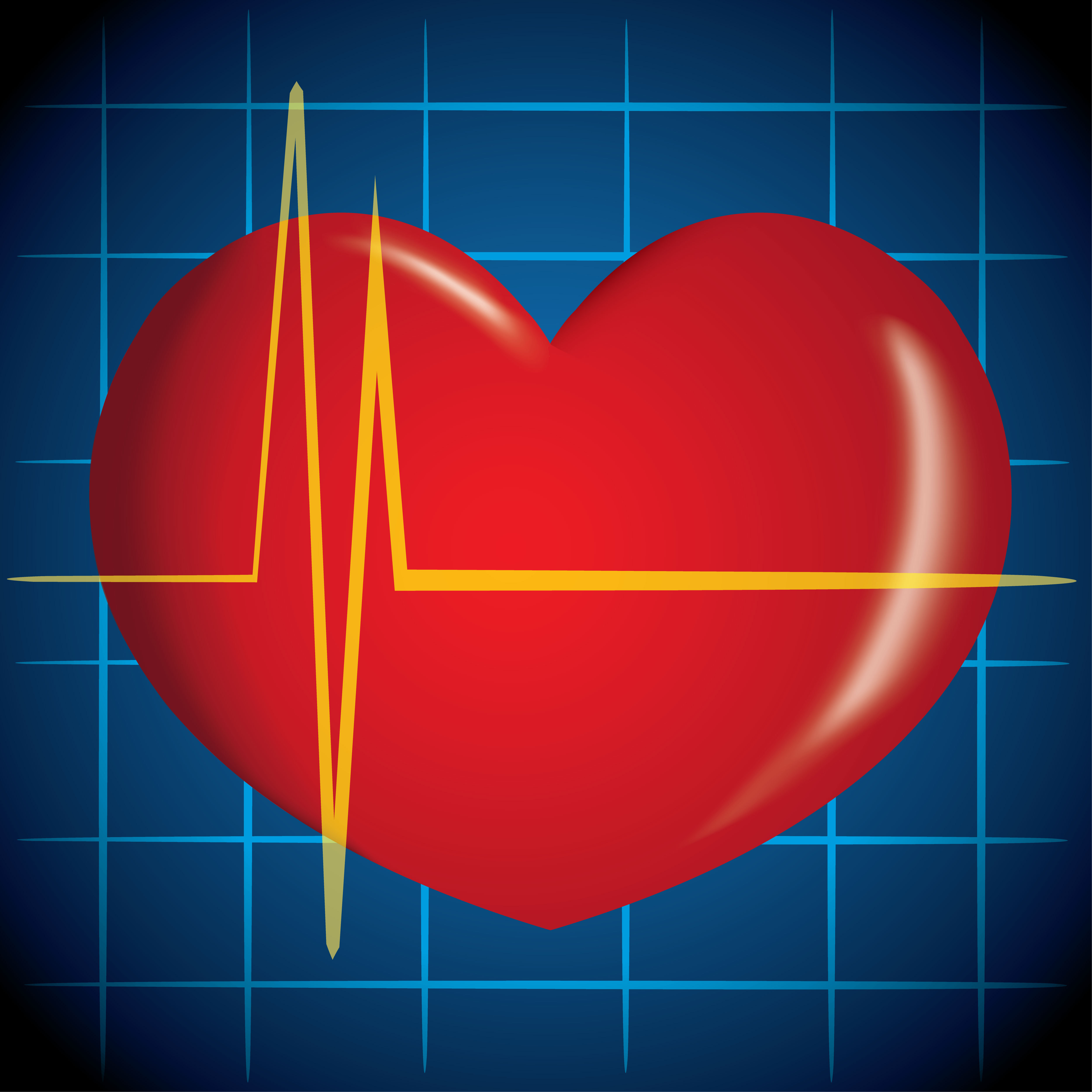 Аритмия сердца: чем опасна, основные виды аритмий