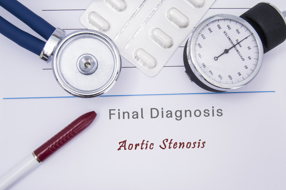 Cтеноз аортального клапана: причины, симптомы, диагностика и лечение