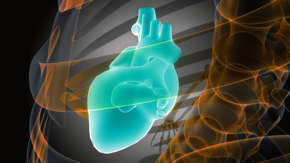 Что такое сцинтиграфия миокарда?