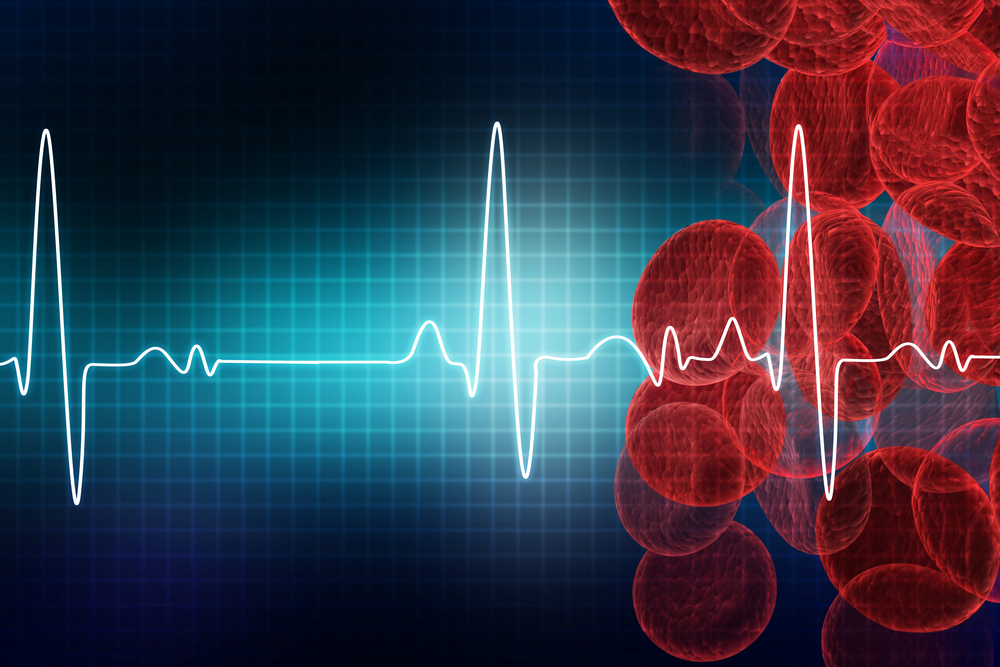 Синдром ранней реполяризации желудочков
