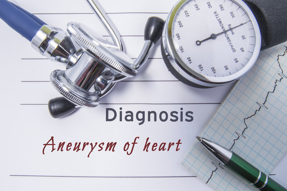Симптомы, диагностика и лечение аневризмы сердца