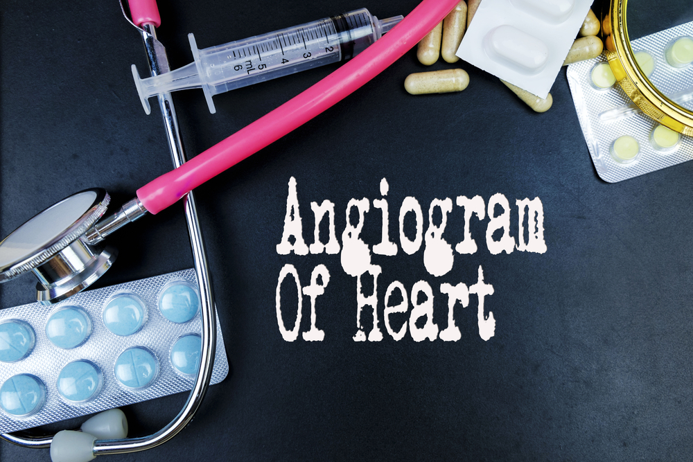 Ангиокардиография: показания, противопоказания, подготовка к исследованию