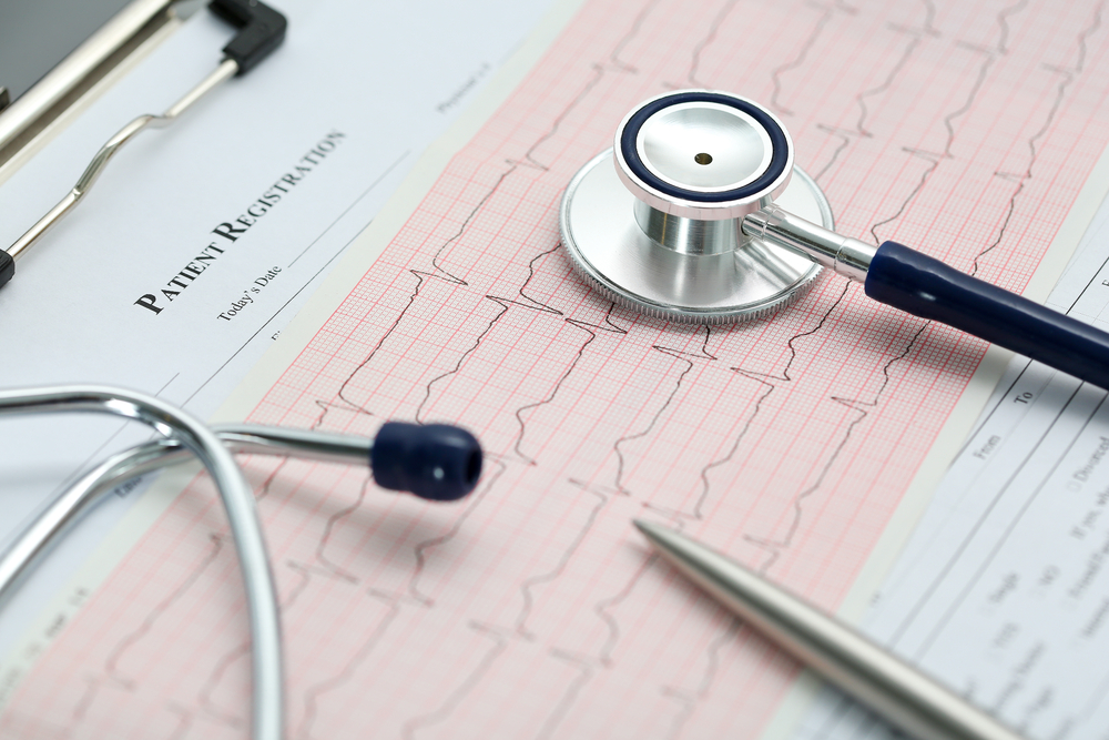 Сверхточная методика лечения аритмий от Сибирских кардиологов