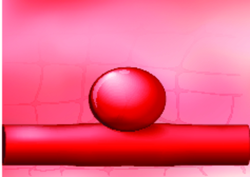 Аневризма почечной артерии: симптомы и лечение