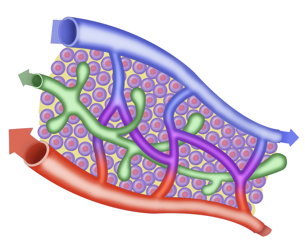 Лимфангиома: симптомы, лечение