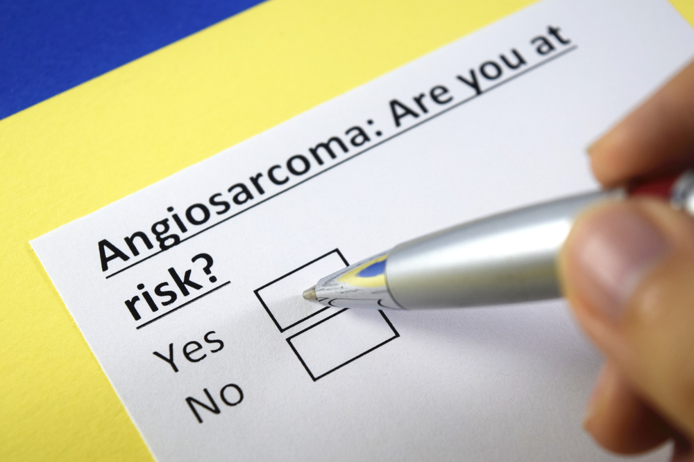 Ангиосаркомы: симптомы, современные методы лечения