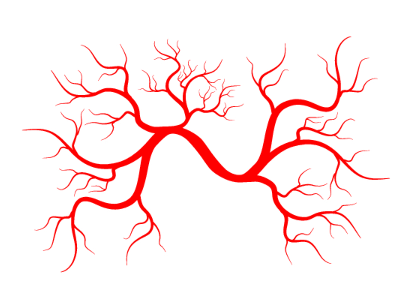 Фиброзно-мышечная дисплазия: причины, симптомы, лечение