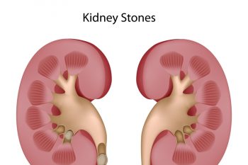 Диета при песке в почках