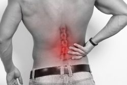 Как лечить остеохондроз в домашних условиях