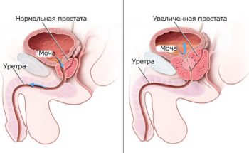 Признаки онкологических заболеваний