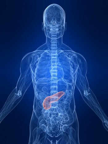 Хронический панкреатит: симптомы и лечение