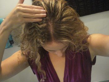 Лечение перхоти у детей