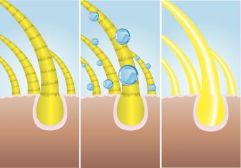 Лечение перхоти у детей
