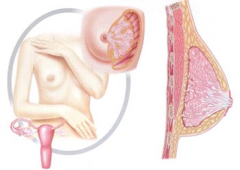 Галакторея: причины, симптомы и лечение