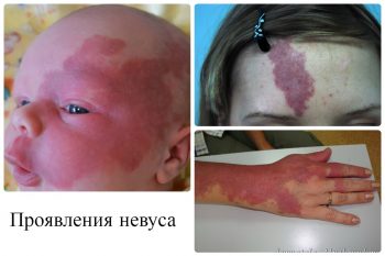 Наиболее распространенные заболевания кожи