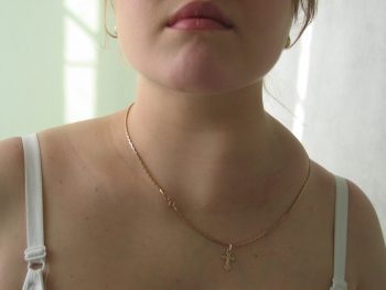 Причины воспаления лимфоузлов