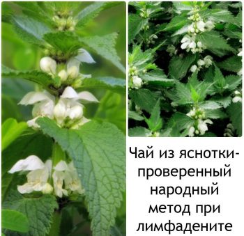 Причины воспаления лимфоузлов