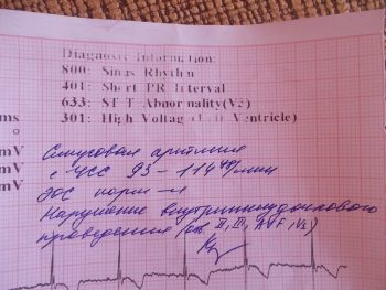 Синусовая аритмия у ребенка: что это такое и что делать?