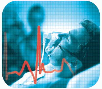 Транзиторная ишемическая атака: причины, лечение и профилактика