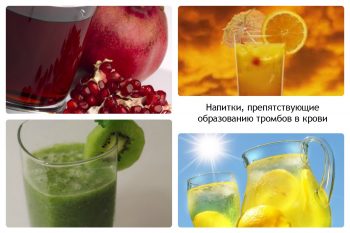 Транзиторная ишемическая атака: причины, лечение и профилактика