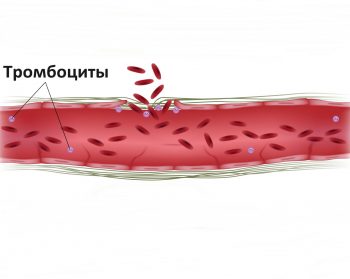 Гемофилия: что это за болезнь и что о ней нужно знать?