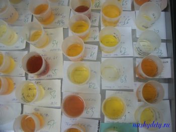 Трактовка анализов мочи у детей