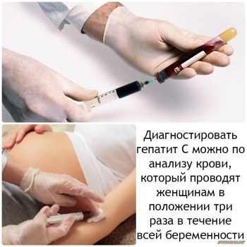 Вирусный гепатит у детей: симптомы, лечение