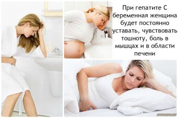 Вирусный гепатит у детей: симптомы, лечение