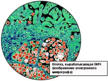 Профилактика ВИЧ-инфекции у детей