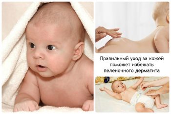 Пеленочный дерматит у детей