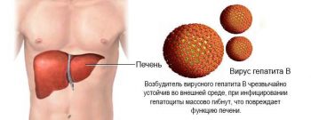 Вирусный гепатит у детей: симптомы, лечение