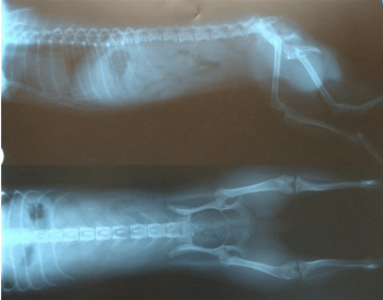 Cпондилез поясничного отдела позвоночника: симптомы и лечение