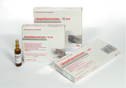 ДЦП у детей