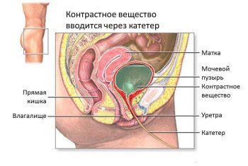 методы диагностики заболеваний мочевого пузыря