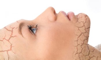 симптомы нарушения обмена веществ у женщин