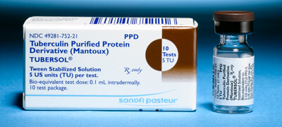 Прививка против туберкулеза детям и проба Манту