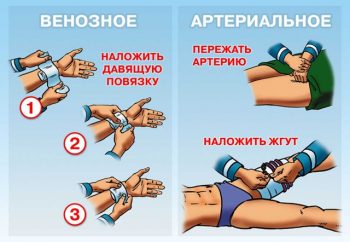 помощь больному с наружным кровотечением
