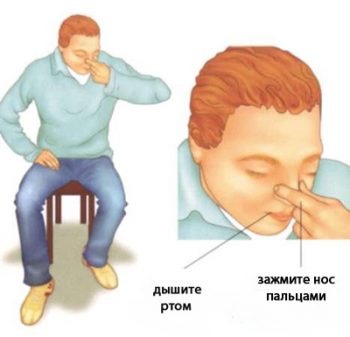 как остановить кровотечение из носа
