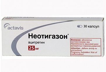 кератодермия