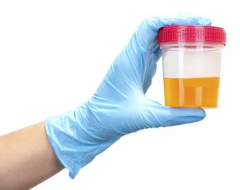 Кетоны в моче при диабете что это значит