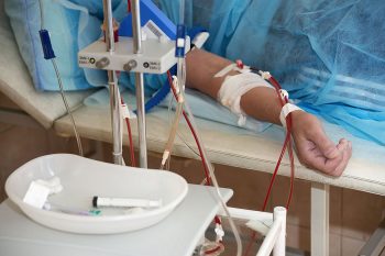 плазмаферез