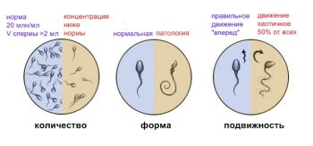 спермограмма