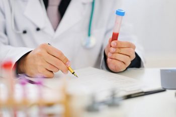 Гипогонадизм у мужчин диагностика