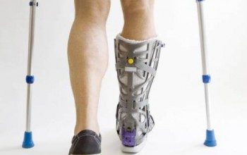 Перелом пяточной кости лечение реабилитация