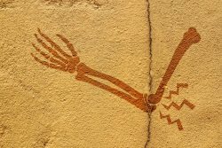 Боли в локтях: причины и лечение