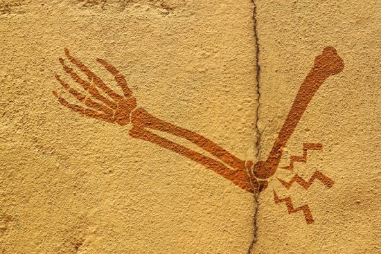 Боли в локтях: причины и лечение